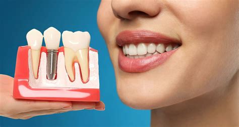 Are Dental Implants Painful? - Oral-B