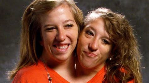 Are abby and brittany hensel separated. Since their birth on March 7, 1990, conjoined twins Abby and Brittany Hensel have been subject to plenty of media coverage. The pair, who are dicephalic parapagus twins (having two heads on one ... 