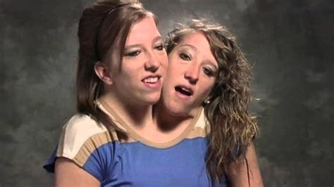 Online. Conjoined twins Abby Hensel and Brittany Hensel would, respectfully, like you to sit back down. After Abby's recent marriage to Josh Bowling brought them back into the spotlight, the 34 .... 