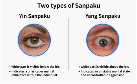 Are sanpaku eyes bad. Nov 1, 2022 · One thing about a person with sanpaku eyes is that he looks like he is in bad shape. 3) Charles Manson has yang sanpaku eyes, which are brown on the bottom and white on top. The eyes of the late cult leader were crazy, with whites covering his irises. 