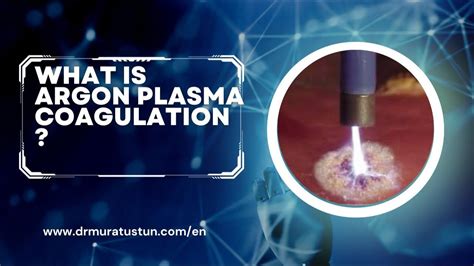 Argon Plasma Coagulation (APC) Offers a Safer and More …