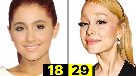 Ariana Grande Plastic Surgery: Did She Really Undergo Plastic Surgery?