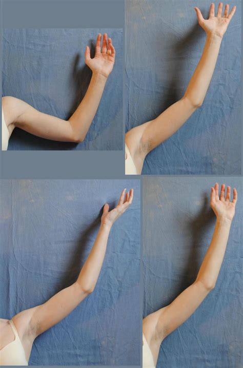 Arm reference photos. Things To Know About Arm reference photos. 