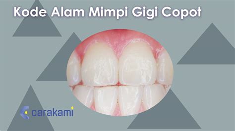 Arti mimpi gigi copot togel. Kode alam mimpi melihat.