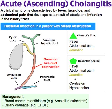 Charcot's cholangitis triad is the combination of jaundice; fever, usually with rigors; and right upper quadrant abdominal pain. It occurs as a result of ascending cholangitis (an infection of the bile duct in the liver). When the presentation also includes low blood pressure and mental status changes, it is known as Reynolds' pentad. It is named for Jean-Martin Charcot. . 