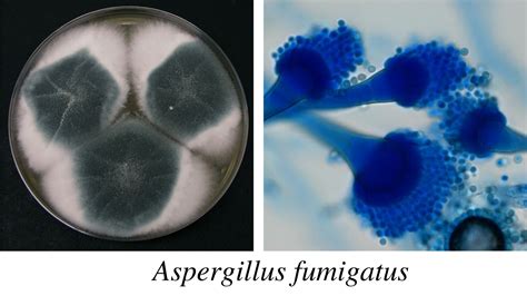 Aspergillus fumigatus and Aspergillosis in 2024 - PMC