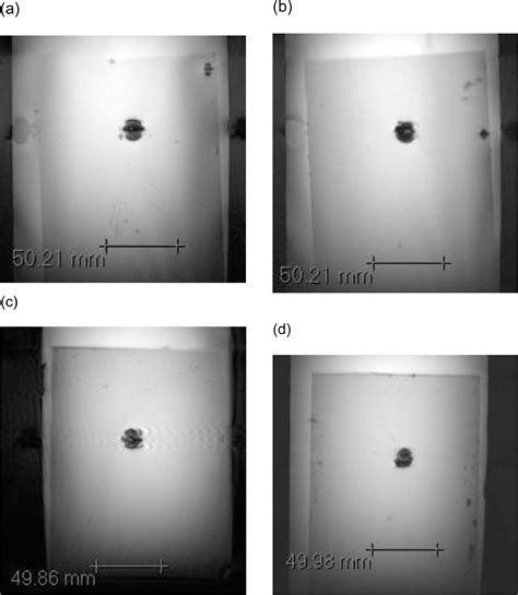 Assessment of MRI safety issues for stainless steel sutures used …