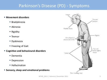 Assessment of Parkinson Disease Manifestations - Perlmutter