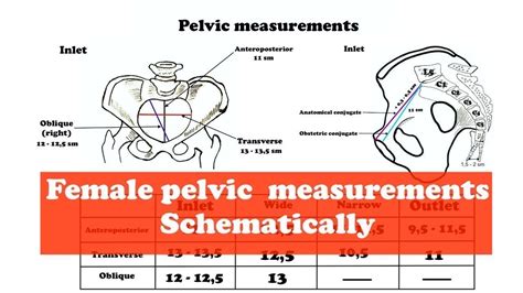 Assessment of the bony pelvis - tabebak.com