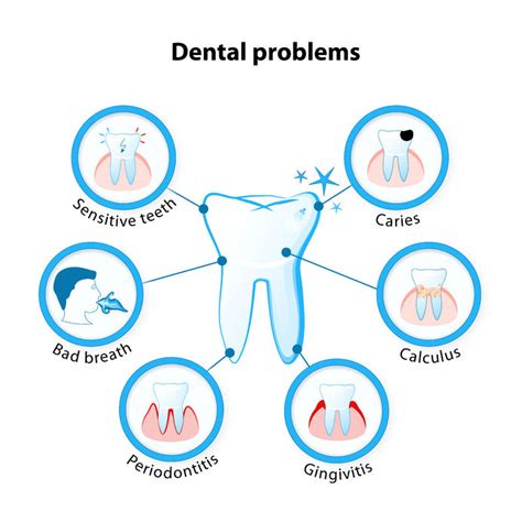 Associations Between Oral Health Status and Diabetic Neuropathy …