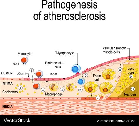 Atherosclerosis - Pathogenesis - SlideShare