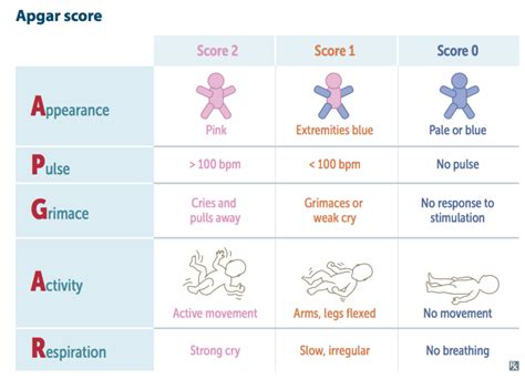 At the one minute APGAR, scores between seven and ten indicate that the baby will need only routine post-delivery care. Scores between four and six indicate that some assistance for breathing might be required. Scores under four can call for prompt, lifesaving measures. At the five minute APGAR, a score of seven to ten is normal.