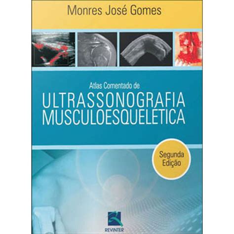Atlas de ultra sonografia do sistema musculoesquelético periférico. - 2010 cub cadet rzt service manual.