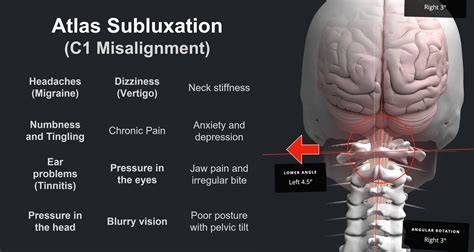Atlas misalignment reddit.  Extremely many conditions are associated wi...