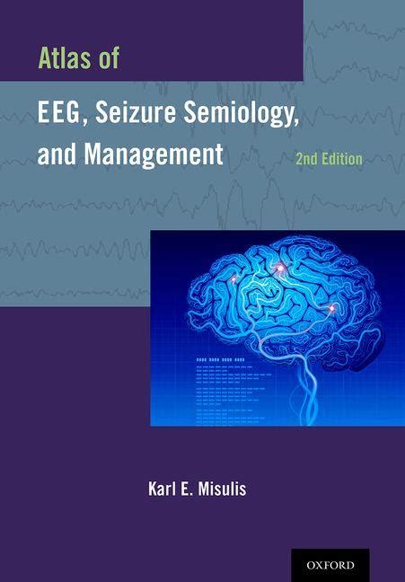 Atlas of Eeg, Seizure Semiology, and Management Hardcover