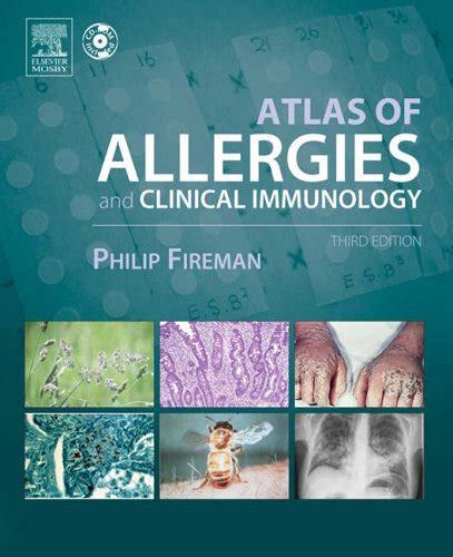 Atlas of allergies and clinical immunology textbook with cd rom. - Orígenes del prejuicio racial en américa.