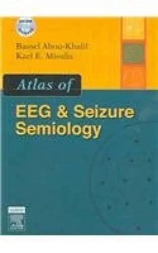 Atlas of eeg seizure semiology text with dvd 1e. - Toyota corolla verso repair manual change oil filter.