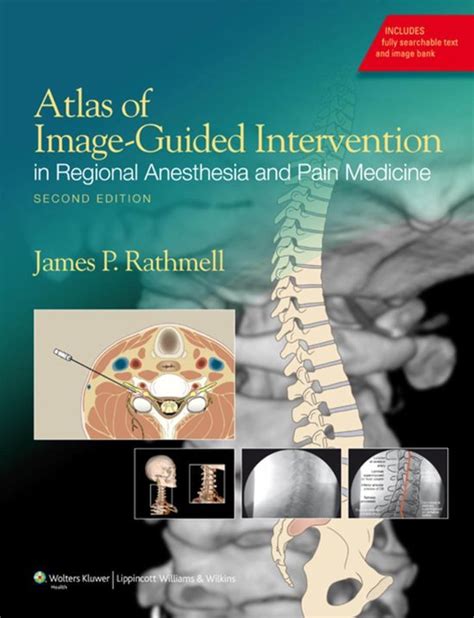 Atlas of image guided intervention in regional anesthesia and pain medicine. - Lexus ls 430 service manual audio.