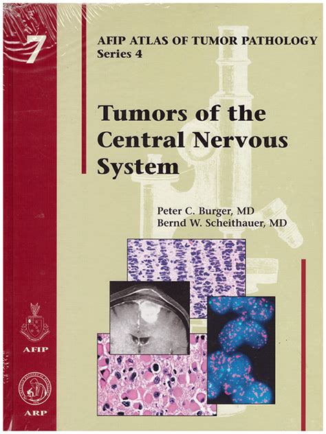 Atlas of tumor pathology tumors of the central nervous system senond series fascicle 6. - Origini e sviluppo di una città giardino.