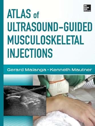 Atlas of ultrasound guided musculoskeletal injections by gerard malanga. - Fretboard secret handbook an awesome way to memorize and practice scale note position on guitar english edition.