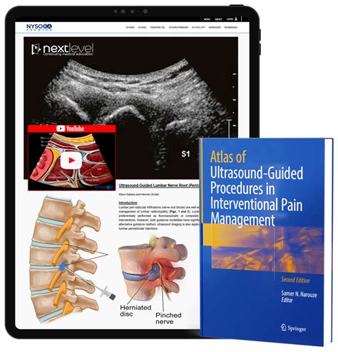 Atlas of ultrasound guided procedures in interventional pain management. - Bridging the gap a parents guide to elementary education in the 21st century.