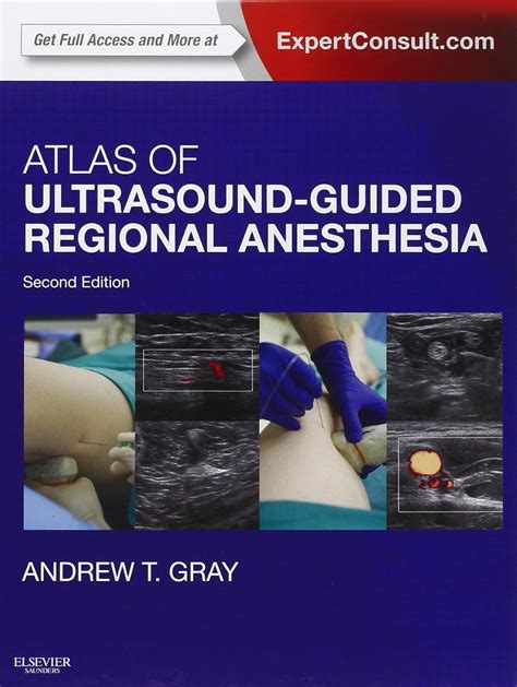 Atlas of ultrasound guided regional anesthesia expert consult online. - Viper 350 2 way installation manual.