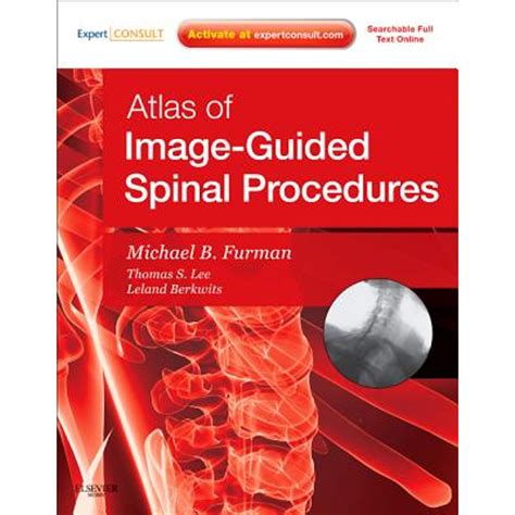 Read Atlas Of Imageguided Spinal Procedures By Michael Bruce Furman