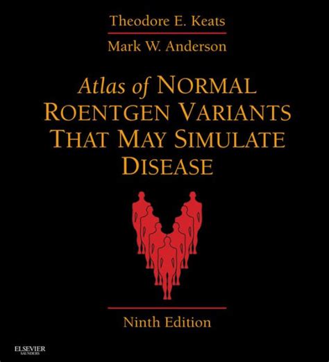 Download Atlas Of Normal Roentgen Variants That May Simulate Disease By Mark W Anderson
