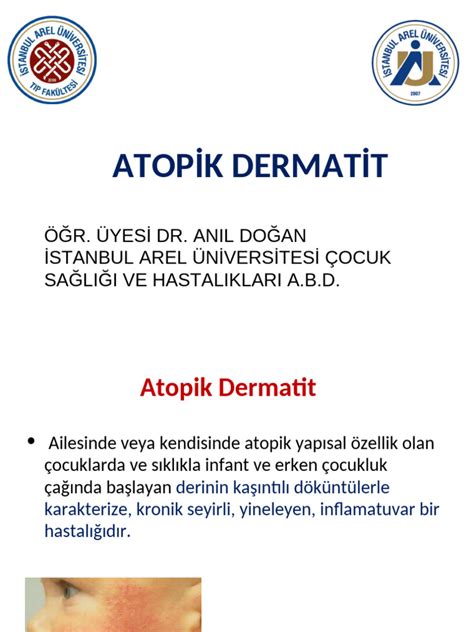 Atopik dermatit Vikipediya.