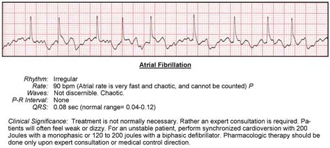  Atrial fibrillation can be interpreted by noting: A - an irregularly irregular rhythm and absent P waves. B - the presence of wide QRS complexes and a rapid rate. C - PR intervals that vary from complex to complex. D - a regularly irregular rhythm with abnormal P waves. . 