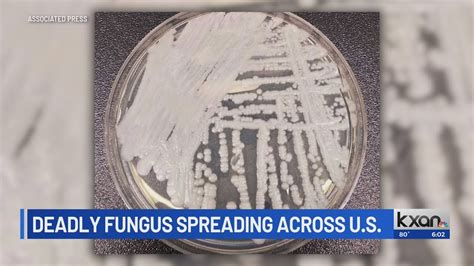 Austin Public Health says deadly fungus spreading in US is a ‘top threat’