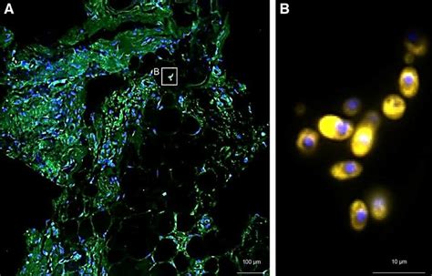 Automated Image Analysis Of Fish Stained Cell Nuclei