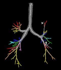 Automated Nomenclature Labeling of the Bronchial Tree in 3D …