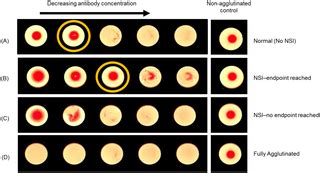 Automated interpretation of influenza hemagglutination ... - PLOS