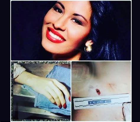 The autopsy report revealed that Selena Quintanilla-Pér