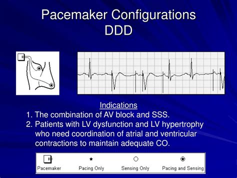 Av-block pacemaker