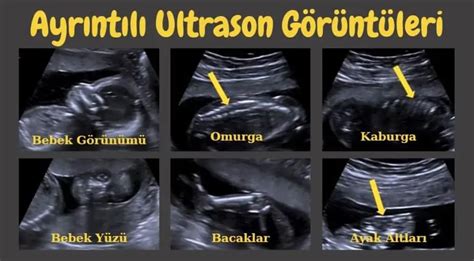 Ayrıntılı ultrason kaç boyutludur