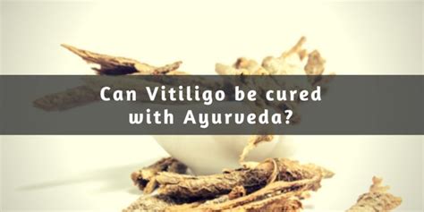 Ayurvedic Treatment for Vitiligo – All you need to know