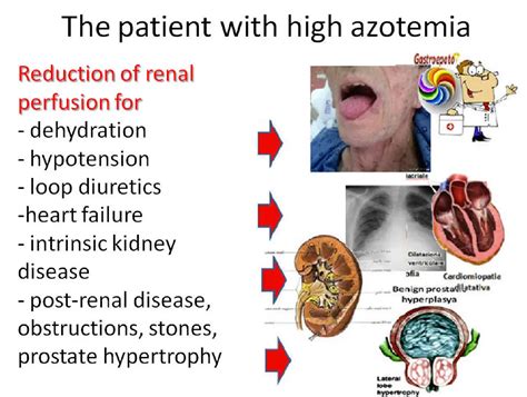 Azotemia Definition & Meaning - Merriam-Webster