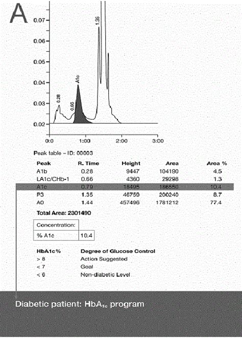 B. HPLC chromatograms with interpretation. The HbA1c …