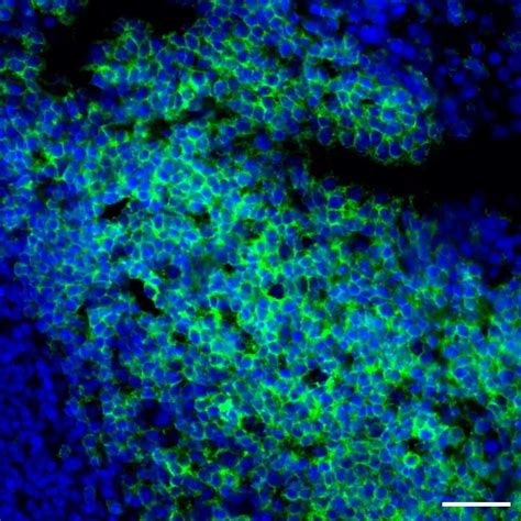 B220 Halı ve Koltuk Yıkama