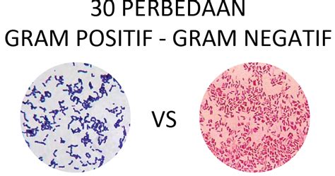 Bakteri Gram Positif & Negatif: Perbedaan Utama! - Halodoc - muktibox.com