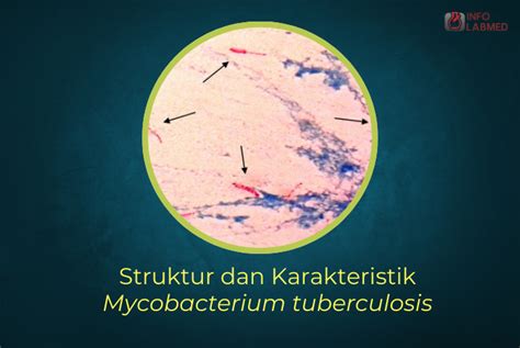 Bakteri Tbc Dalam Mikroskop - wintechmobiles.com