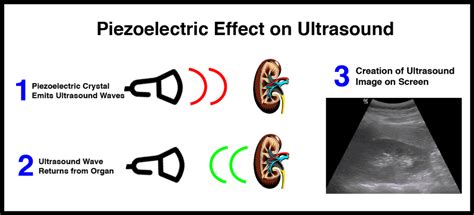 Basic Principles of Ultrasound Physics and Artifacts … - wintechmobiles.com