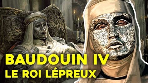 Baudouin IV dari Yerusalem - Wikipedia bahasa … - wintechmobiles.com