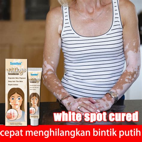 Bintik Putih Raksasa - Wikipedia bahasa Indonesia, ensiklopedia bebas - muktibox.com