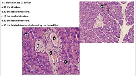 Block 2 Week 2 Practice Questions Flashcards | Quizlet - wintechmobiles.com
