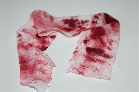 Blood and bandages - Hektoen International - wintechmobiles.com