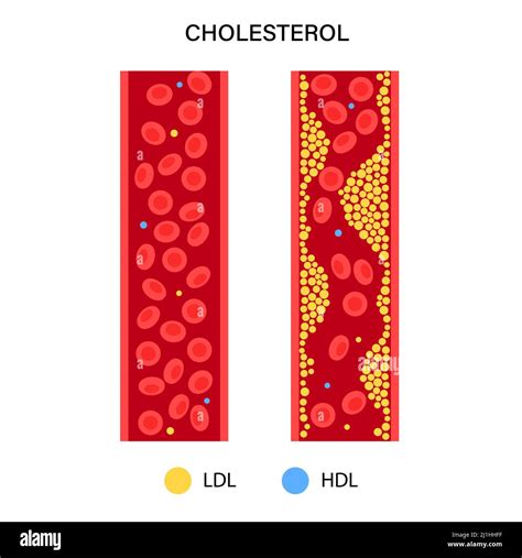 Blood Cholesterol - What is Blood Cholesterol? | NHLBI, NIH - muktibox.com