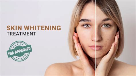 body whitening treatment - elchoricharrua.com